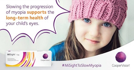 Misight-Soft-Contact-Lenses